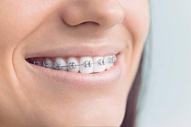 Why Choose Us for Your Dental Needs in Cocoa Beach, FL